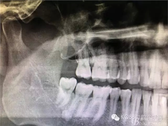 30.webp.jpg 30.webp.jpg