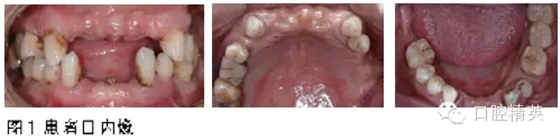 1.webp.jpg 1.webp.jpg