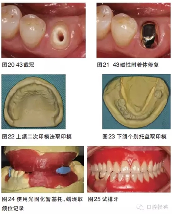 9.webp.jpg 9.webp.jpg