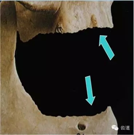 1.webp.jpg 1.webp.jpg