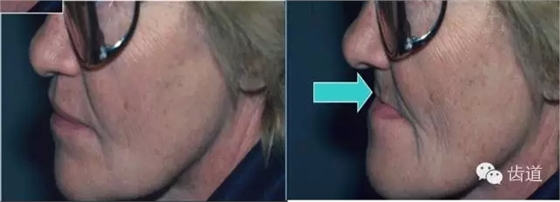 6.webp.jpg 6.webp.jpg