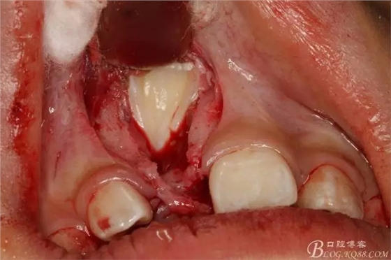 10.webp.jpg 10.webp.jpg