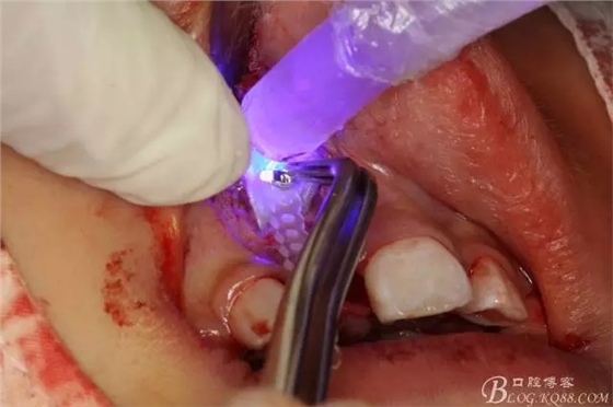 13.webp.jpg 13.webp.jpg