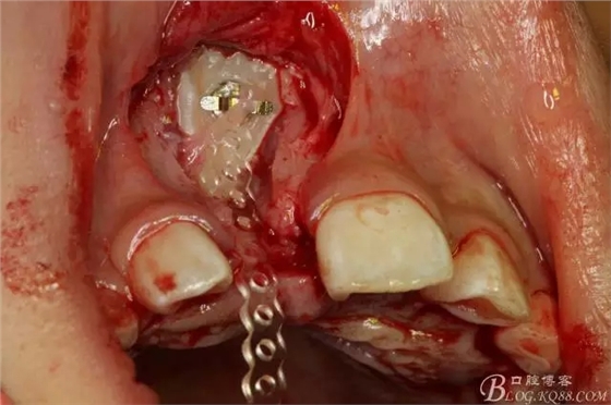 14.webp.jpg 14.webp.jpg