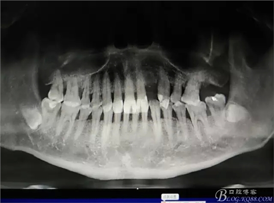 1.webp.jpg 1.webp.jpg