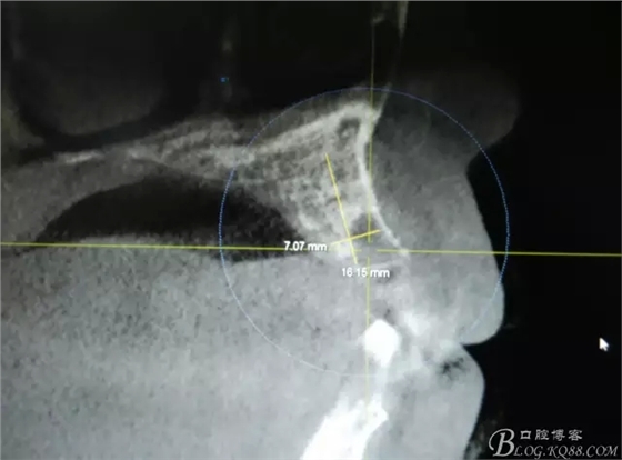 3.webp.jpg 3.webp.jpg