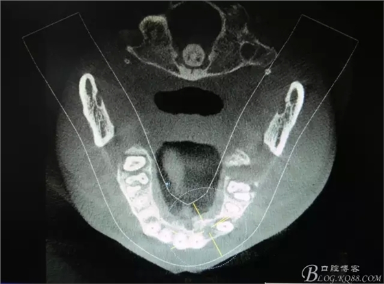 4.webp.jpg 4.webp.jpg