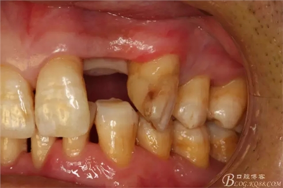 6.webp.jpg 6.webp.jpg