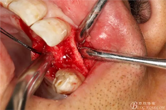 8.webp.jpg 8.webp.jpg