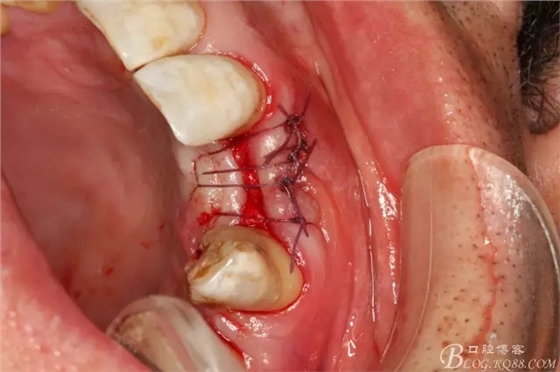 12.webp.jpg 12.webp.jpg