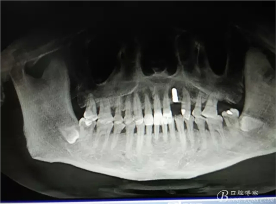 14.webp.jpg 14.webp.jpg