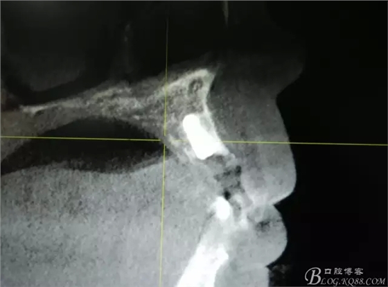 15.webp.jpg 15.webp.jpg