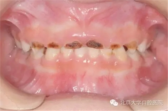 1.webp.jpg 1.webp.jpg