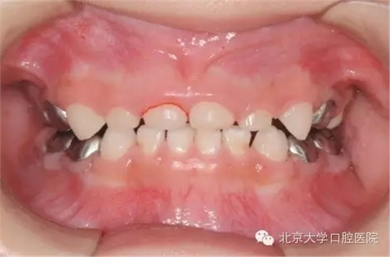 2.webp.jpg 2.webp.jpg