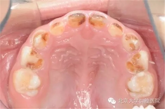 3.webp.jpg 3.webp.jpg