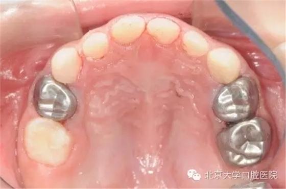 4.webp.jpg 4.webp.jpg