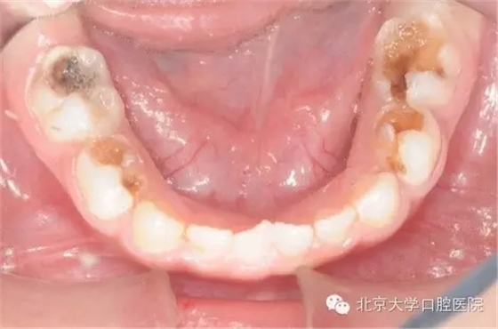 5.webp.jpg 5.webp.jpg