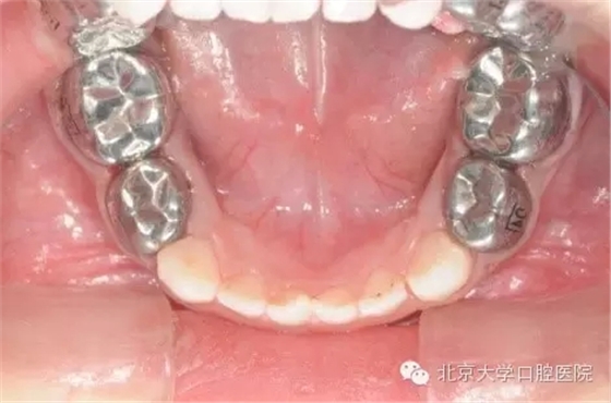 6.webp.jpg 6.webp.jpg