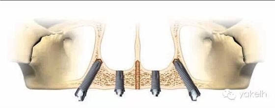 1.webp.jpg 1.webp.jpg