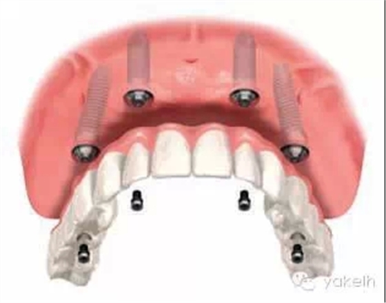 3.webp.jpg 3.webp.jpg