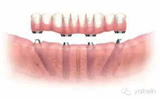 4.webp.jpg 4.webp.jpg