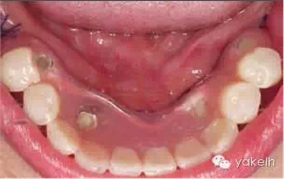 6.webp.jpg 6.webp.jpg