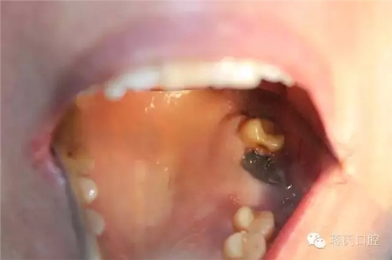 2.webp.jpg 2.webp.jpg