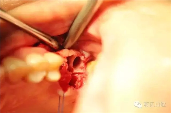 3.webp.jpg 3.webp.jpg