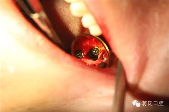 6.webp.jpg 6.webp.jpg