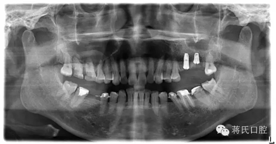 8.webp.jpg 8.webp.jpg