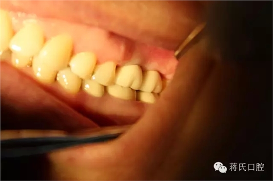 11.webp.jpg 11.webp.jpg