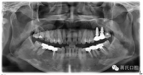 12.webp.jpg 12.webp.jpg