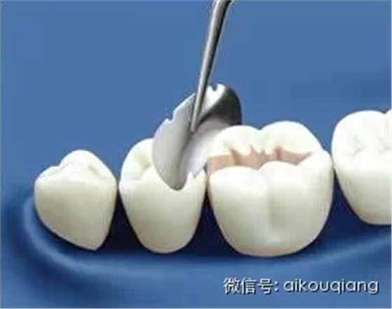 5.webp.jpg 5.webp.jpg