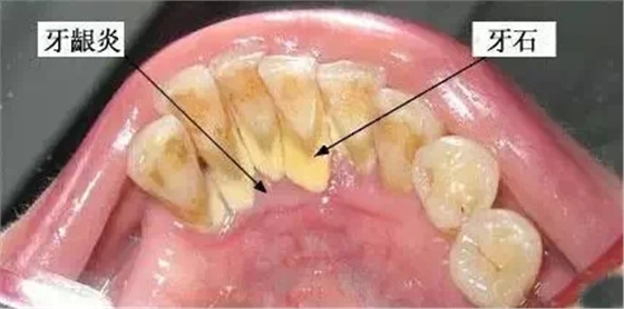 1.webp.jpg 1.webp.jpg