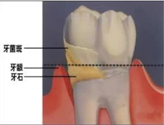 4.webp.jpg 4.webp.jpg