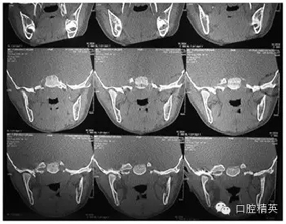 3.1.webp.jpg 3.1.webp.jpg