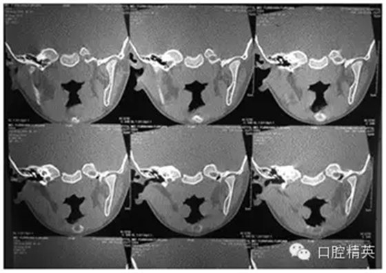 32.webp.jpg 32.webp.jpg