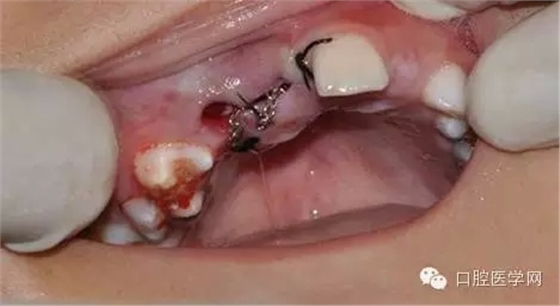 32.webp.jpg 32.webp.jpg