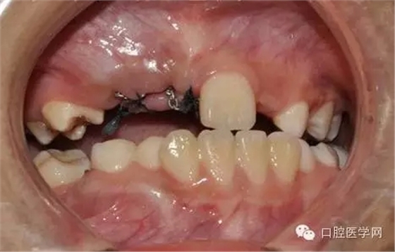 33.webp.jpg 33.webp.jpg