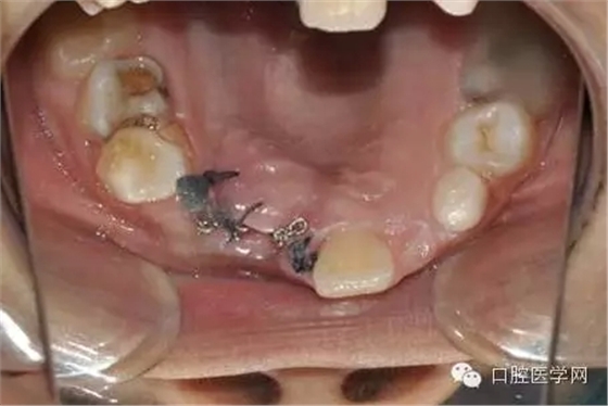 34.webp.jpg 34.webp.jpg