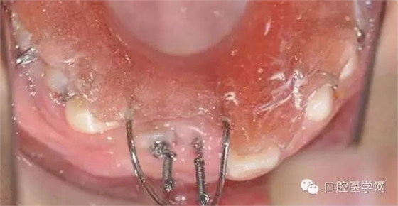 37.webp.jpg 37.webp.jpg