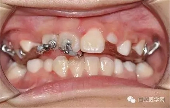 42.webp.jpg 42.webp.jpg