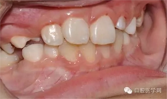 44.webp.jpg 44.webp.jpg