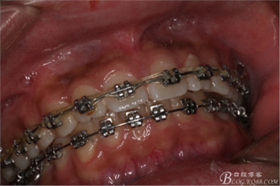 2_副本.jpg 2_副本.jpg