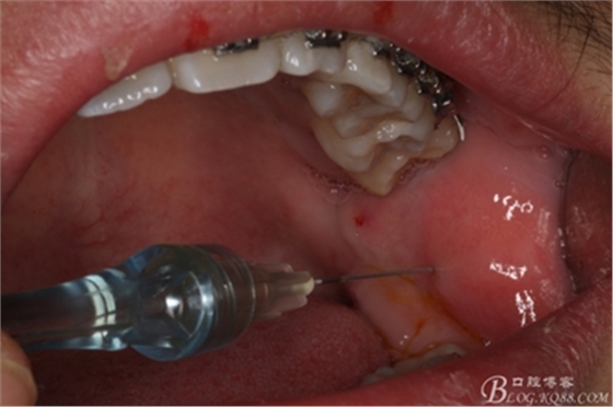 4_副本.jpg 4_副本.jpg