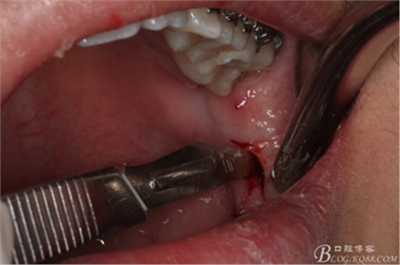 5_副本.jpg 5_副本.jpg