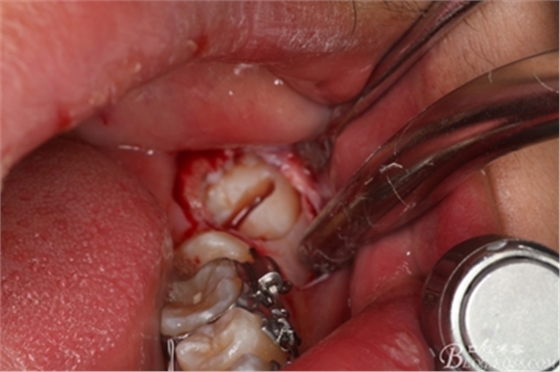 12_副本.jpg 12_副本.jpg