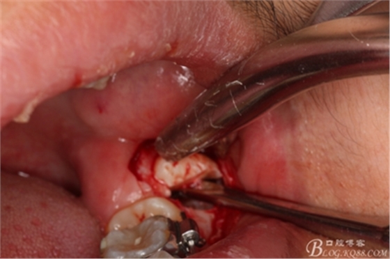 14_副本.jpg 14_副本.jpg