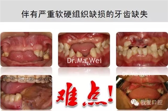 1.webp.jpg 1.webp.jpg