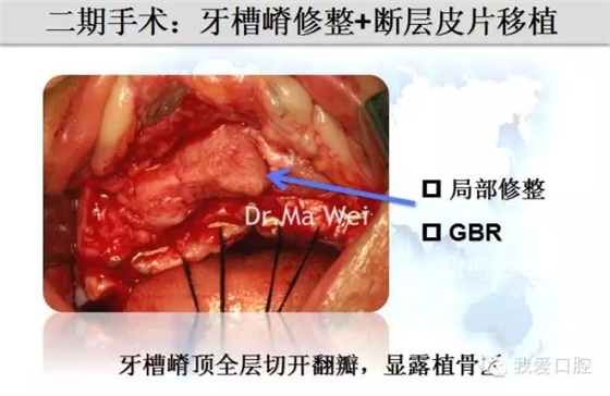 6.webp.jpg 6.webp.jpg